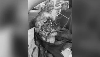 В Сочи собаки разорвали лицо 9-летнего ребенка