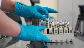 Анализ на ВПЧ стал доступен для жительниц России по ОМС