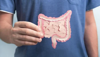 Эра &laquo;быстрых перекусов&raquo;: почему рак кишечника все чаще встречается у людей 30 лет