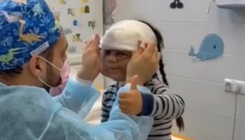 Девочке в &laquo;маске Бэтмена&raquo; провели новую операцию по удалению родимого пятна