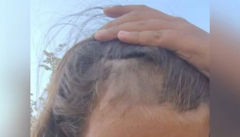 В Подмосковье возбудили дело после того, как группа подростков остригла девочку