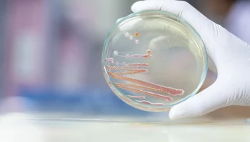 &laquo;Настоящий монстр&raquo;: какая бактерия убила девять младенцев в роддоме Новокузнецка