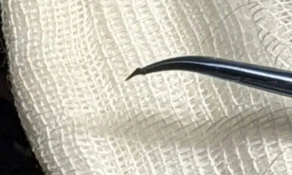 Столичные ветеринары спасли зрение собаке, в глаз которой воткнулся шип от розы