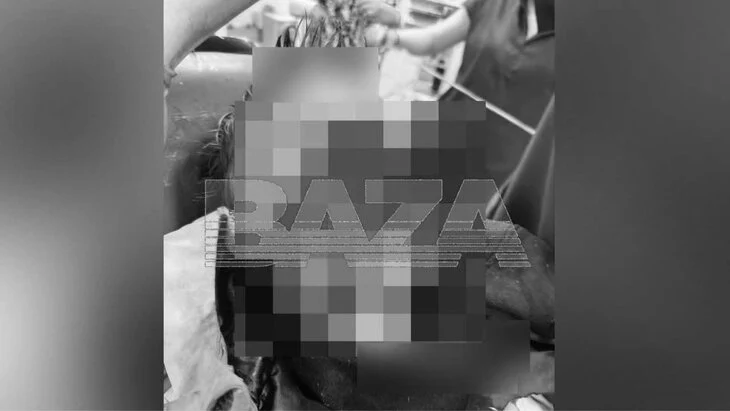 Отец изувеченного собаками мальчика рассказал о его состоянии Отец изувеченного собаками мальчика рассказал о его состоянии