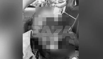 Пострадавший от нападения собак в Сочи мальчик пришел в сознание после искусственной комы