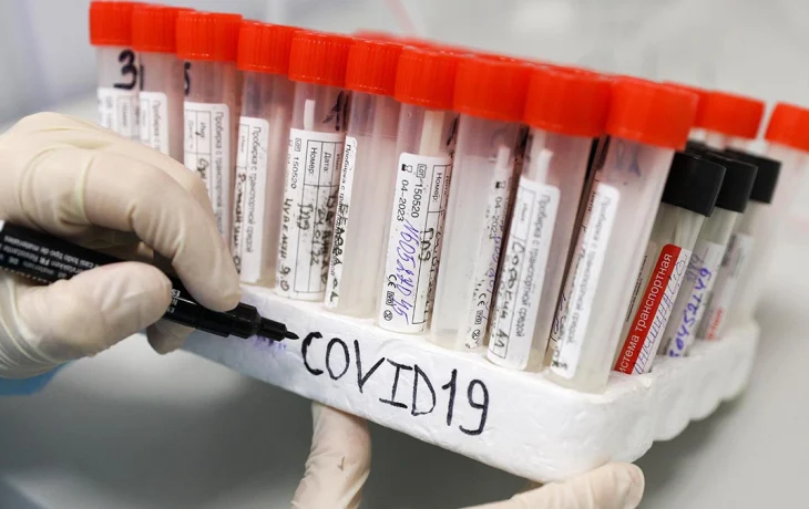 В Госсовете Китая заявили, что вызывающий COVID-19 коронавирус появился в США В Госсовете Китая заявили, что вызывающий COVID-19 коронавирус появился в США