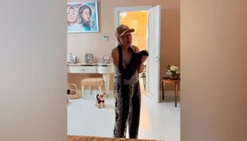 Певица Любовь Успенская рассказала о перенесенной операции на руке