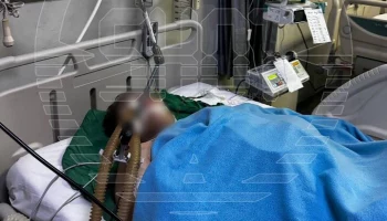 Врачи стабилизировали состояние российского подростка, попавшего в ДТП на Бали