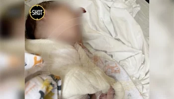 Омбудсмен заявила, что семья ребенка с переломами из Истры состоит на учете