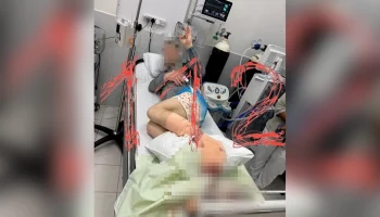 "Известия": мужчина чуть не лишился ноги после нападения акулы на Мальдивах