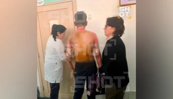 Пересадка кожи потребуется одному из пострадавших при нападении на школу Красноярска