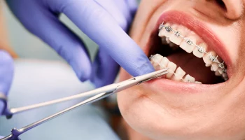 Стоматолог Суджаев объяснил, почему неправильный прикус опасен для здоровья