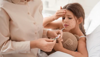 Россиянам рассказали, как защититься от ветрянки без вакцины