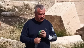 Раненый военкор НТВ Ивлиев остается под наблюдением врачей