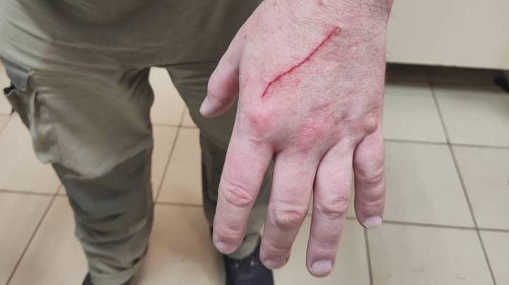 Панда Катюша расцарапала руку и живот работнику Московского зоопарка